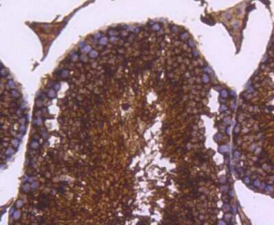 Immunohistochemistry-Paraffin: Lactate Dehydrogenase A/LDHA Antibody (SU39-06) [NBP2-67483]