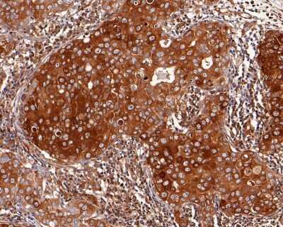 Immunohistochemistry-Paraffin: Lactate Dehydrogenase A/LDHA Antibody (SU39-06) [NBP2-67483]