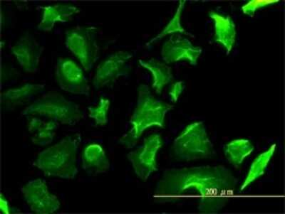 Immunocytochemistry/ Immunofluorescence: Lactate Dehydrogenase B Antibody (2H6) [H00003945-M01]
