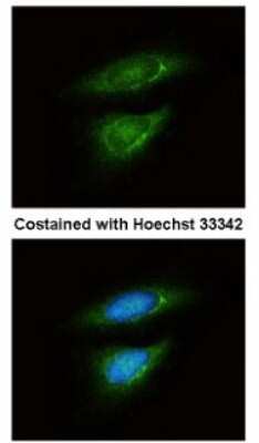 Immunocytochemistry/ Immunofluorescence: Lactate Dehydrogenase B Antibody [NBP1-31945]