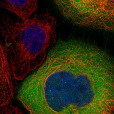 Immunocytochemistry/ Immunofluorescence: Lactate Dehydrogenase B Antibody [NBP2-38131]