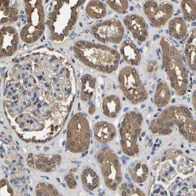 Immunohistochemistry-Paraffin: Lactate Dehydrogenase B Antibody [NBP2-38131]