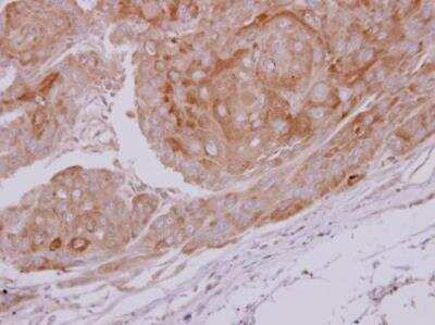 Immunohistochemistry-Paraffin: Lactate Dehydrogenase C Antibody [NBP2-19321]