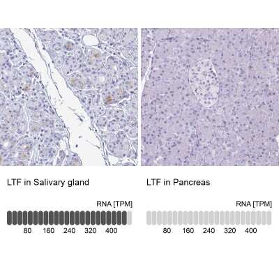 Immunohistochemistry-Paraffin: Lactoferrin Antibody [NBP2-38823]