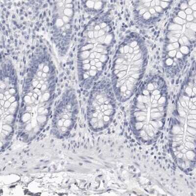 Immunohistochemistry-Paraffin: Lactoperoxidase Antibody [NBP1-87010]