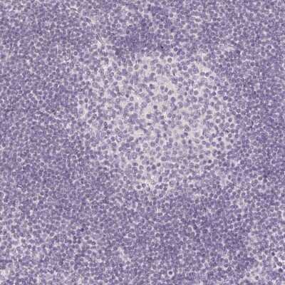 Immunohistochemistry-Paraffin: Laeverin Antibody [NBP2-47404]