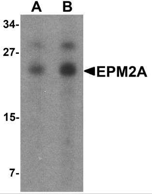 Western Blot: Laforin/EPM2A AntibodyBSA Free [NBP2-81945]