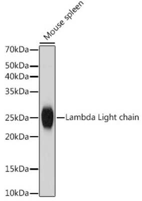 Western Blot: Lambda Light Chain Antibody (1R9H8) [NBP3-15947]