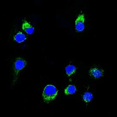 Immunocytochemistry/ Immunofluorescence: Lambda Light Chain Antibody (HP6054) [NBP2-22386]