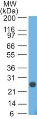 Western Blot: Lambda Light Chain Antibody (HP6054) [NBP2-22386]