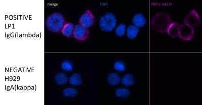 Immunocytochemistry/ Immunofluorescence: Lambda Light Chain Antibody (LcN-2 + ICO-106) [NBP2-34236]