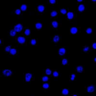 Immunocytochemistry/ Immunofluorescence: Lambda Light Chain Antibody (LcN-2) [NBP2-62751]