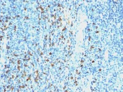 Immunohistochemistry-Paraffin: Lambda Light Chain Antibody (SPM559) - Azide and BSA Free [NBP2-34424]