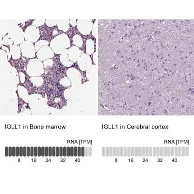 Immunohistochemistry-Paraffin: Lambda5/IGLL1 Antibody [NBP2-56431]