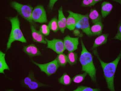 Immunocytochemistry/ Immunofluorescence: Lamin A + C Antibody [NBP2-25153]