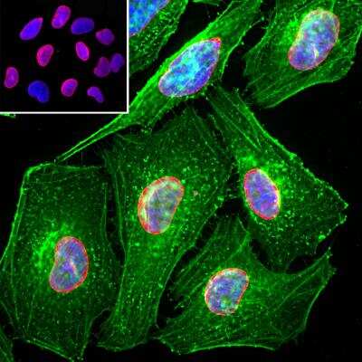 Immunocytochemistry/ Immunofluorescence: Lamin A + C Antibody [NBP2-25152]