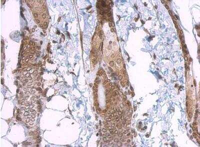Immunohistochemistry-Paraffin: Lamin A + C Antibody [NBP2-19323]