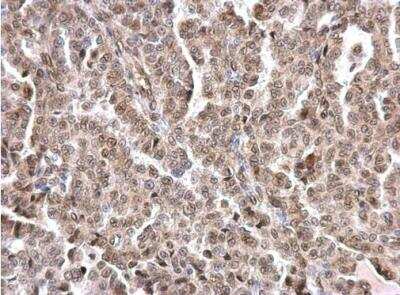 Immunohistochemistry-Paraffin: Lamin A + C Antibody [NBP2-19323]