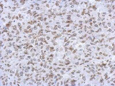 Immunohistochemistry-Paraffin: Lamin A + C Antibody [NBP2-19324]