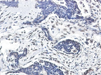 Immunohistochemistry-Paraffin: Lamin A + C Antibody (S07-1I5) [NBP3-19988]