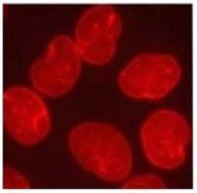 Immunocytochemistry/ Immunofluorescence: Lamin A + C Antibody (mab636) [NB100-74451]