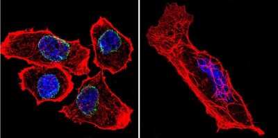 Immunocytochemistry/ Immunofluorescence: Lamin A + C Antibody (mab636) [NB100-74451]