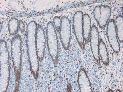 Immunohistochemistry-Paraffin: Lamin A + C Antibody (133A2) [NBP1-97688]