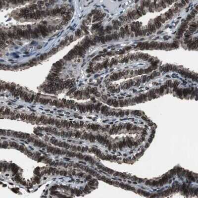 Immunohistochemistry-Paraffin: Lamin A + C Antibody [NBP1-85550]