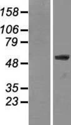 Western Blot: Lamin A + C Overexpression Lysate [NBL1-12565]