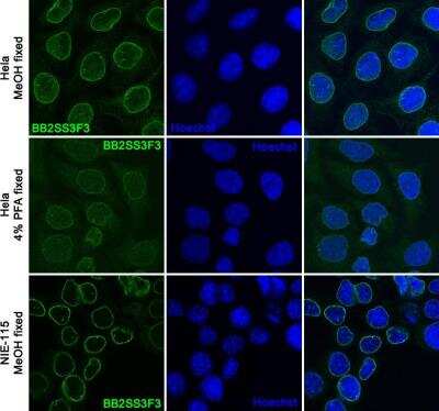 Immunocytochemistry/ Immunofluorescence: Lamin B Receptor Antibody (BB2SS3F3) [NBP2-59947]