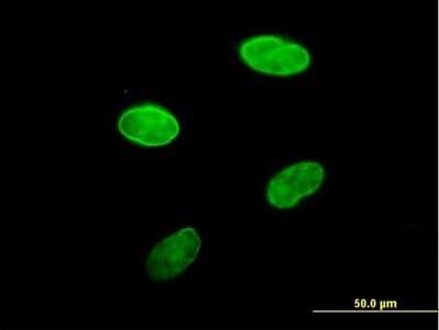 Immunocytochemistry/ Immunofluorescence: Lamin B Receptor Antibody [H00003930-B01P]