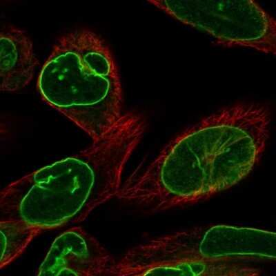 Immunocytochemistry/ Immunofluorescence: Lamin B Receptor Antibody [NBP2-56993]