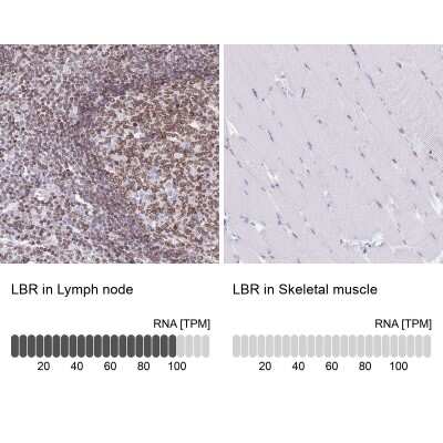 Immunohistochemistry-Paraffin: Lamin B Receptor Antibody [NBP2-14185]