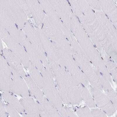 Immunohistochemistry-Paraffin: Lamin B Receptor Antibody [NBP2-14185]