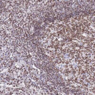 Immunohistochemistry-Paraffin: Lamin B Receptor Antibody [NBP2-14185]