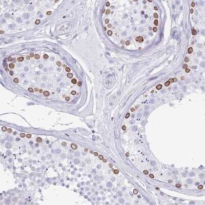 Immunohistochemistry-Paraffin: Lamin B Receptor Antibody [NBP2-14185]