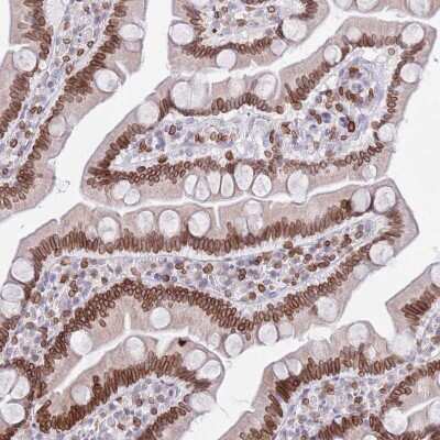 Immunohistochemistry-Paraffin: Lamin B Receptor Antibody [NBP2-14185]