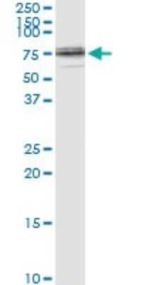Immunoprecipitation: Lamin B1 Antibody (4B10) [H00004001-M01]