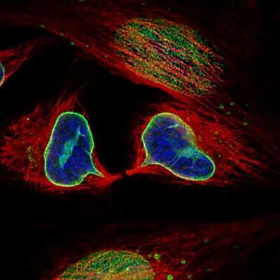 Immunocytochemistry/ Immunofluorescence: Lamin B1 Antibody (CL3929) [NBP2-59783]