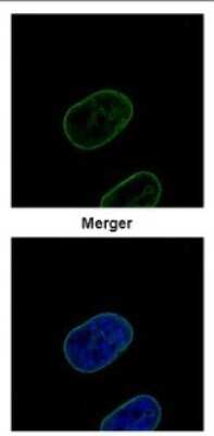 Immunocytochemistry/ Immunofluorescence: Lamin B2 Antibody [NBP2-19325]