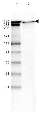Western Blot: Laminin Antibody (CL2968) [NBP2-42384]