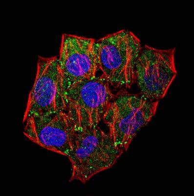 Fluorescent Staining of Laminin in HeLa Cells