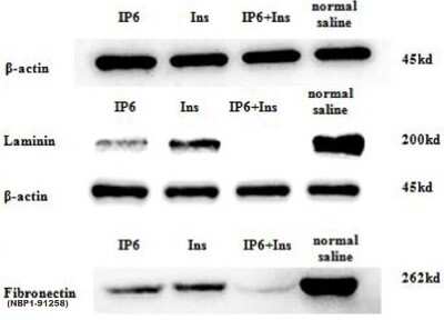 Western Blot Detection of Lamimin in Treated Mouse Cells