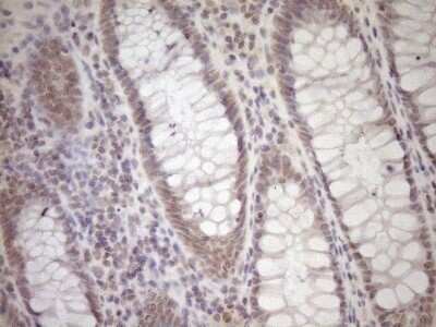 Immunohistochemistry: Laminin S/Laminin beta 2 Antibody (OTI3B4) [NBP2-45583]