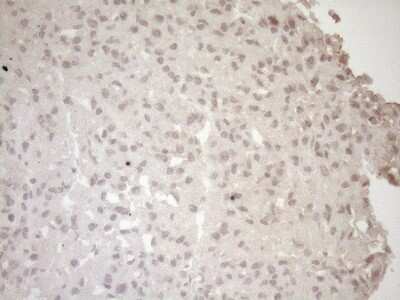 Immunohistochemistry: Laminin S/Laminin beta 2 Antibody (OTI3B4) [NBP2-45583]