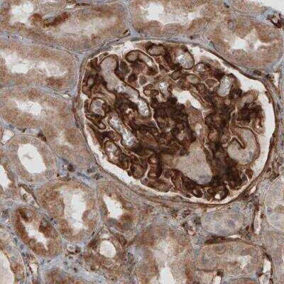 Immunohistochemistry-Paraffin: Laminin S/Laminin beta 2 Antibody (CL2976) [NBP2-42386]