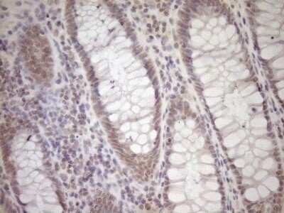 Immunohistochemistry: Laminin S/Laminin beta 2 Antibody (OTI3B4) - Azide and BSA Free [NBP2-71114]