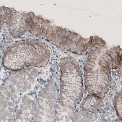 Immunohistochemistry-Paraffin: Laminin alpha 3 Antibody (CL3112) [NBP2-42390]
