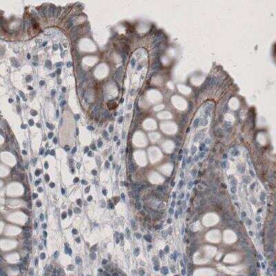 Immunohistochemistry-Paraffin: Laminin alpha 3 Antibody (CL3112) [NBP2-42390]