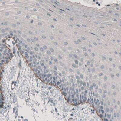 Immunohistochemistry-Paraffin: Laminin alpha 3 Antibody (CL3112) [NBP2-42390]